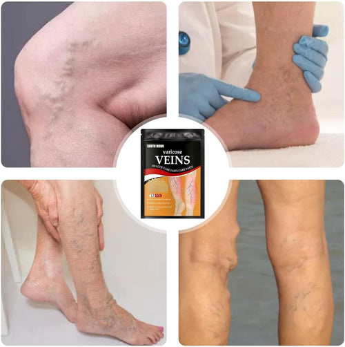 VeinsRelief™ Parches 4x1 para Várices